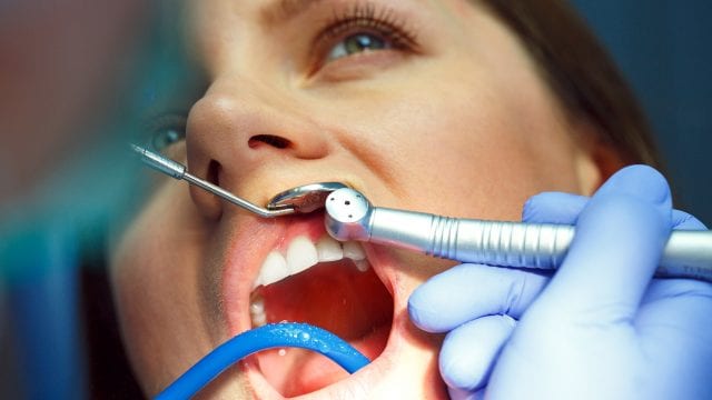 Periodontal Disease and Dental Care – The Basics - WhiteOut Press